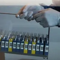 Belçika'da Batı Nil virüsü vakası sayısı artıyor