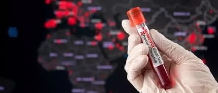 Borsalarda M çiçeği etkisi: İlaç kazandırdı, hava yolu kaybettirdi