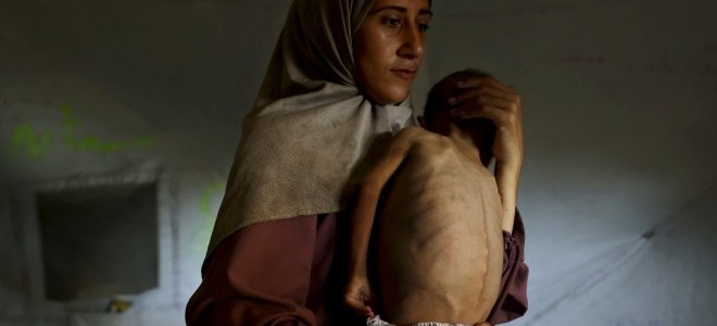 Gazze’deki poşet bezli bebek savaşın acı sembolü hâline geldi