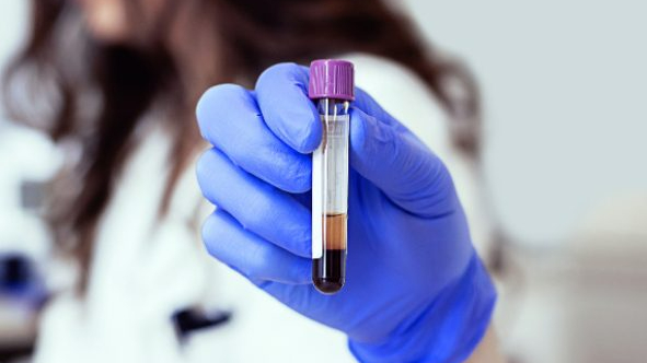 Kanser tedavisinde likit biyopsi dönemi başlıyor