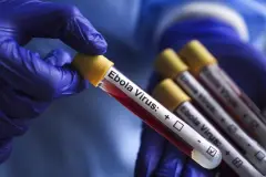 Kongo'da Ebola salgını vaka sayısı 1155'e yükseldi