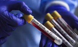 Kongo'da Ebola salgını vaka sayısı 1155'e yükseldi