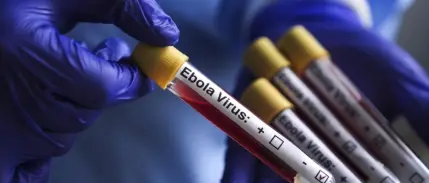 Kongo'da Ebola salgını vaka sayısı 1155'e yükseldi