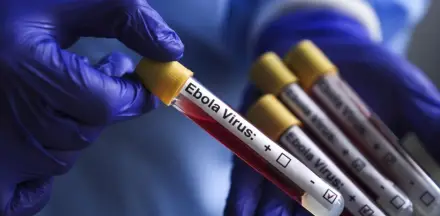 Kongo Demokratik Cumhuriyeti'nde Ebola vakası sayısı 8 bini aştı