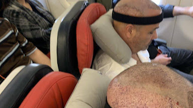 Türkiye afro saç ekiminde dünya lideri haline geldi