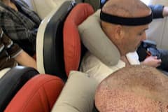 Türkiye afro saç ekiminde dünya lideri haline geldi