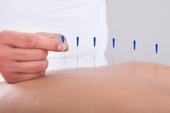 Yönetmelik yenilendi: Geleneksel tıp uygulamalarına erişim kolaylaştırıldı